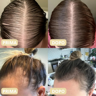 Gripple® | Olio di Batana Naturale per la Crescita dei Capelli